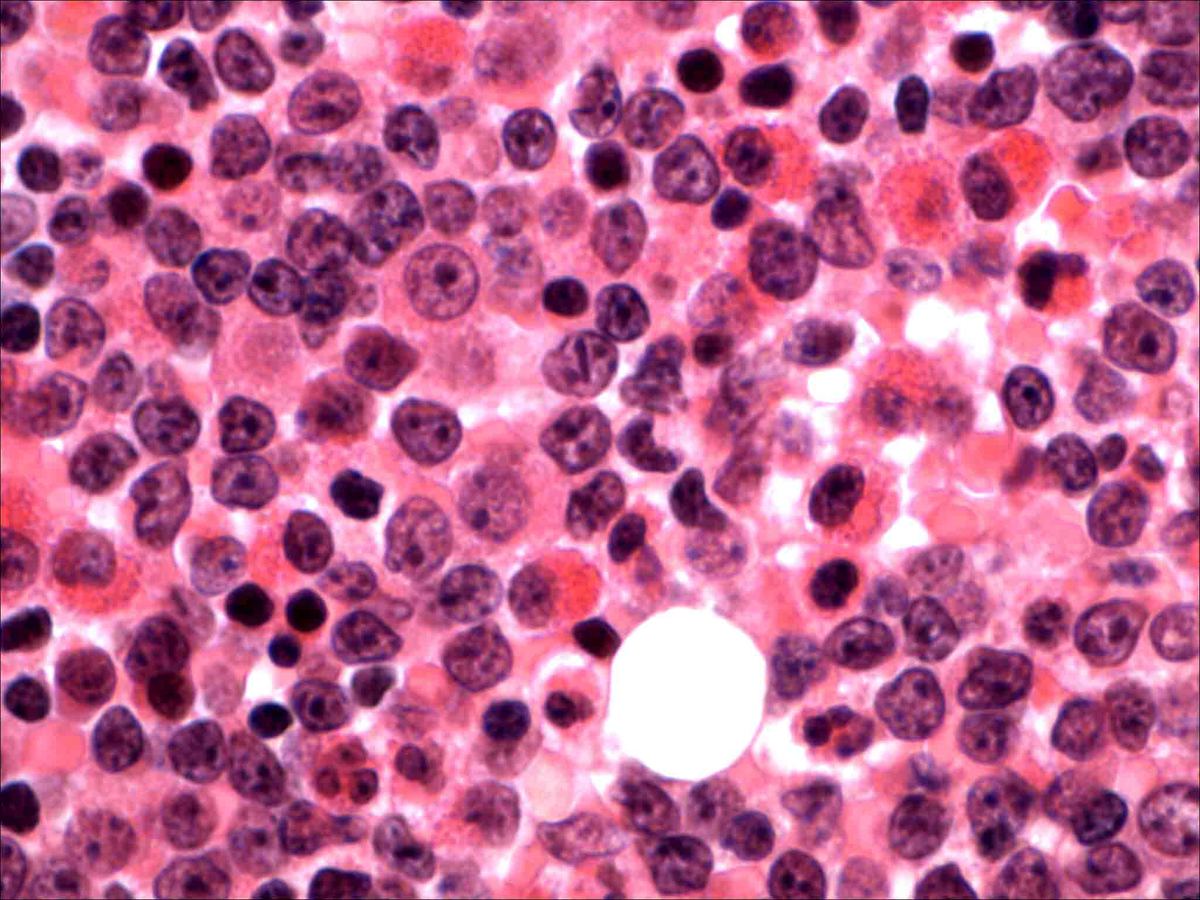 Bone marrow biopsy, 60X